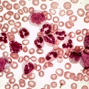 Как увеличить количество белых клеток крови